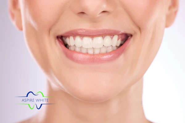 Follow your teeth whitening aftercare Wigan to prolong your whiter smile!